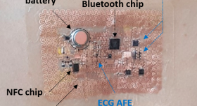 A diagram showing the components of an ecg chip.