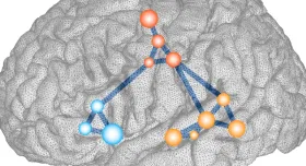 A diagram of a brain with different colored dots.