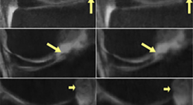A series of x - rays of the knee with arrows pointing in different directions.